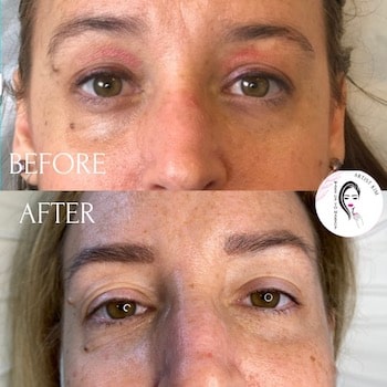 Permanent Under-Eye Concealer - Wake Up To Makeup Naples 350_x_350_jpg