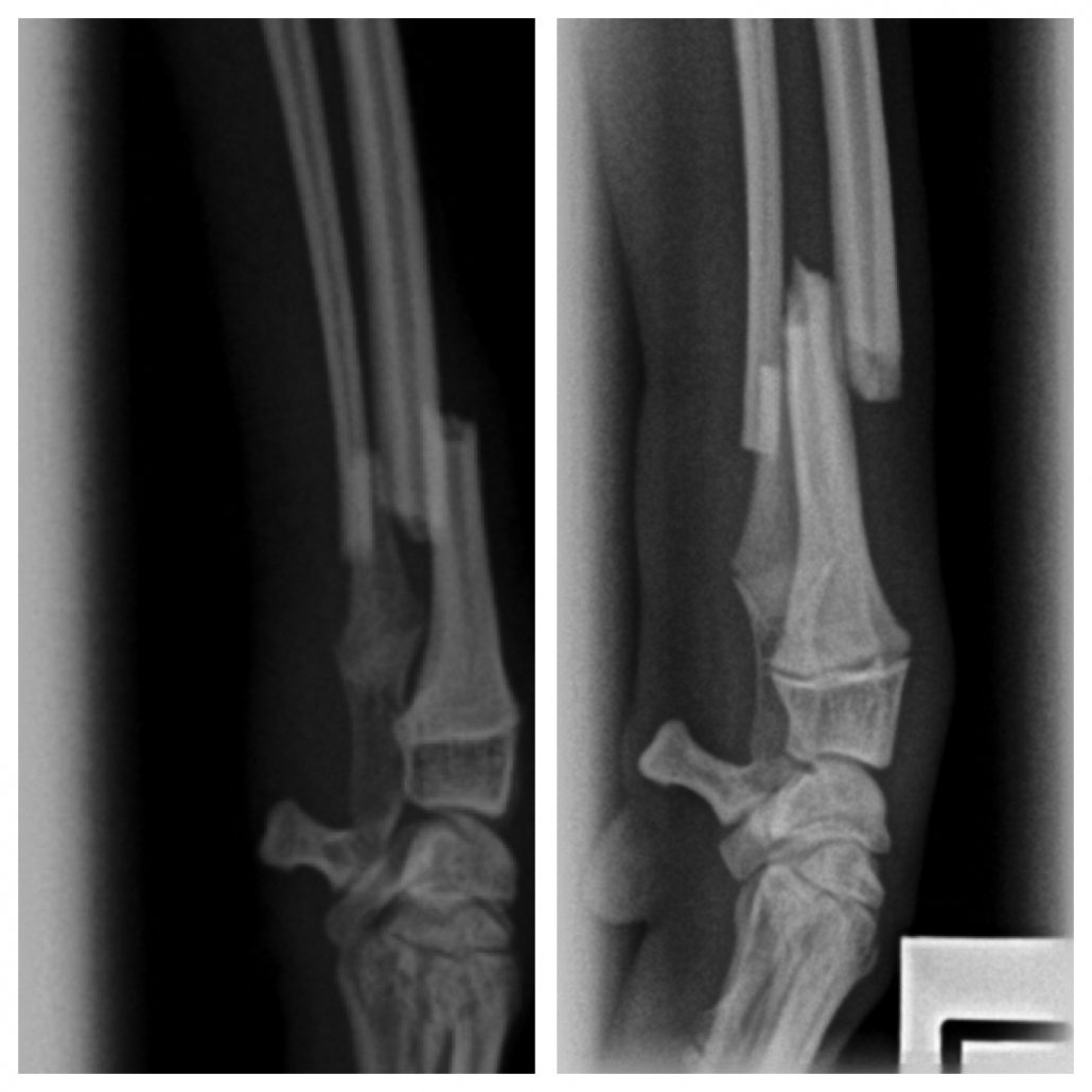 Tendonitis is an inflammation of a tendon—the tough cord of tissue that connects muscles to bones. 20 Causes Of Lameness & Limping In Dogs | Walkerville Vet