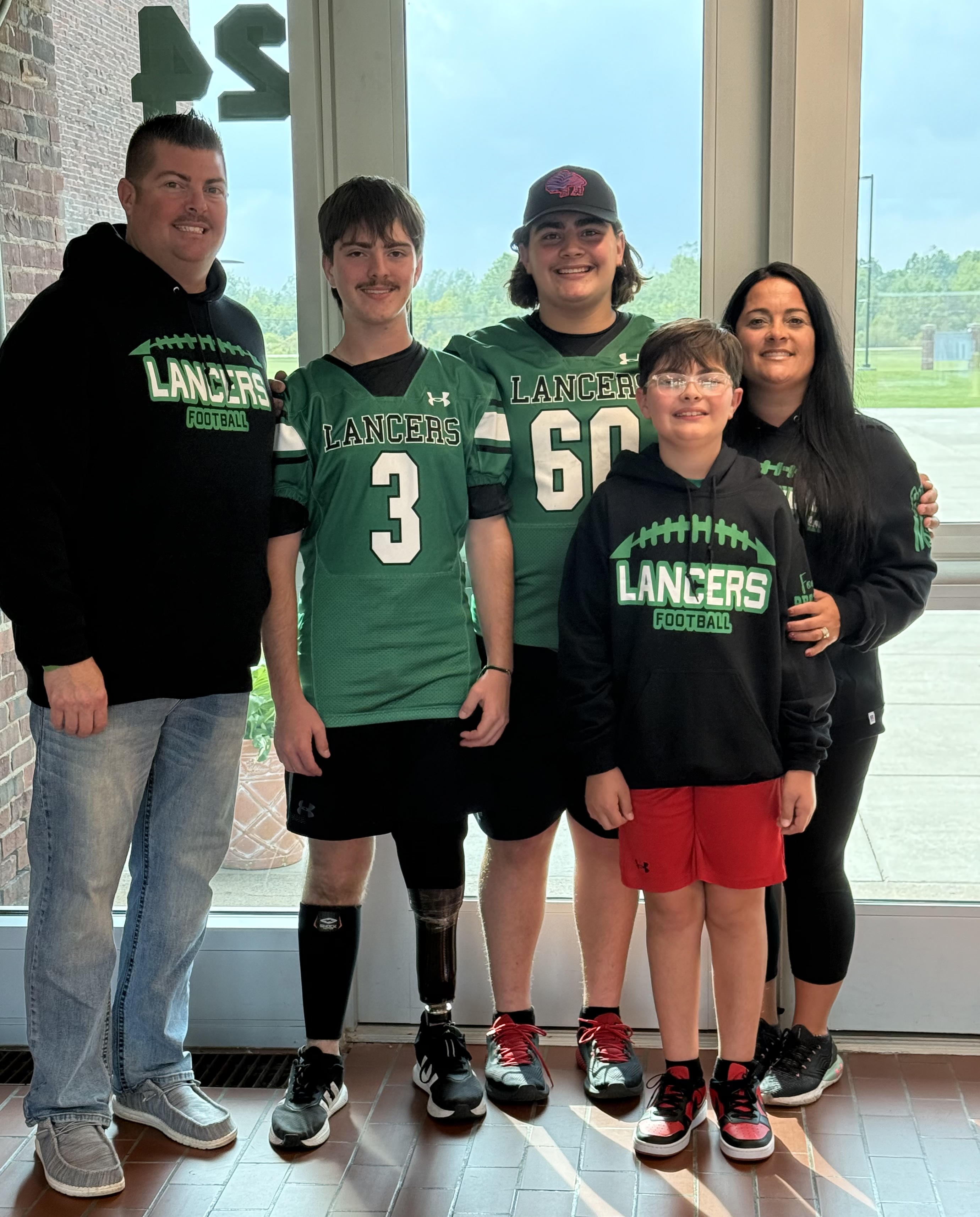 Amputee Gavin Burns defied the odds and now plays football