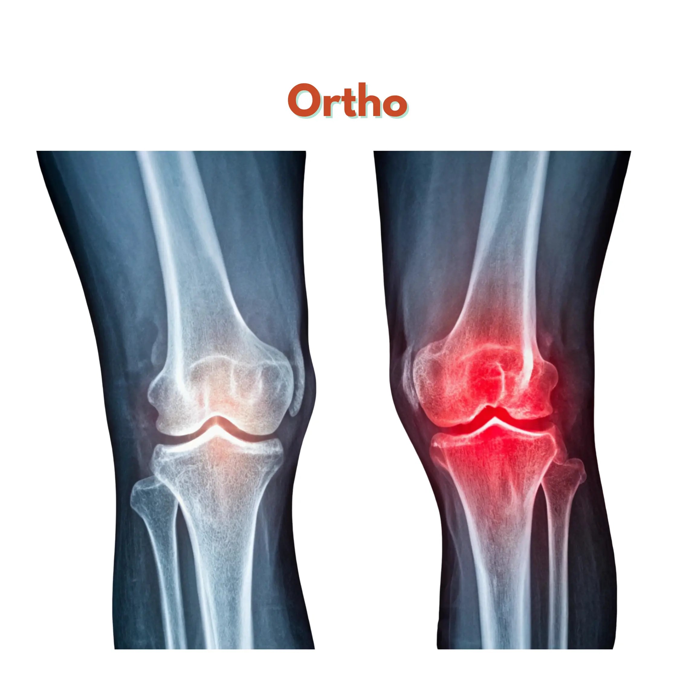 Orthopaedics (Ortho Products)