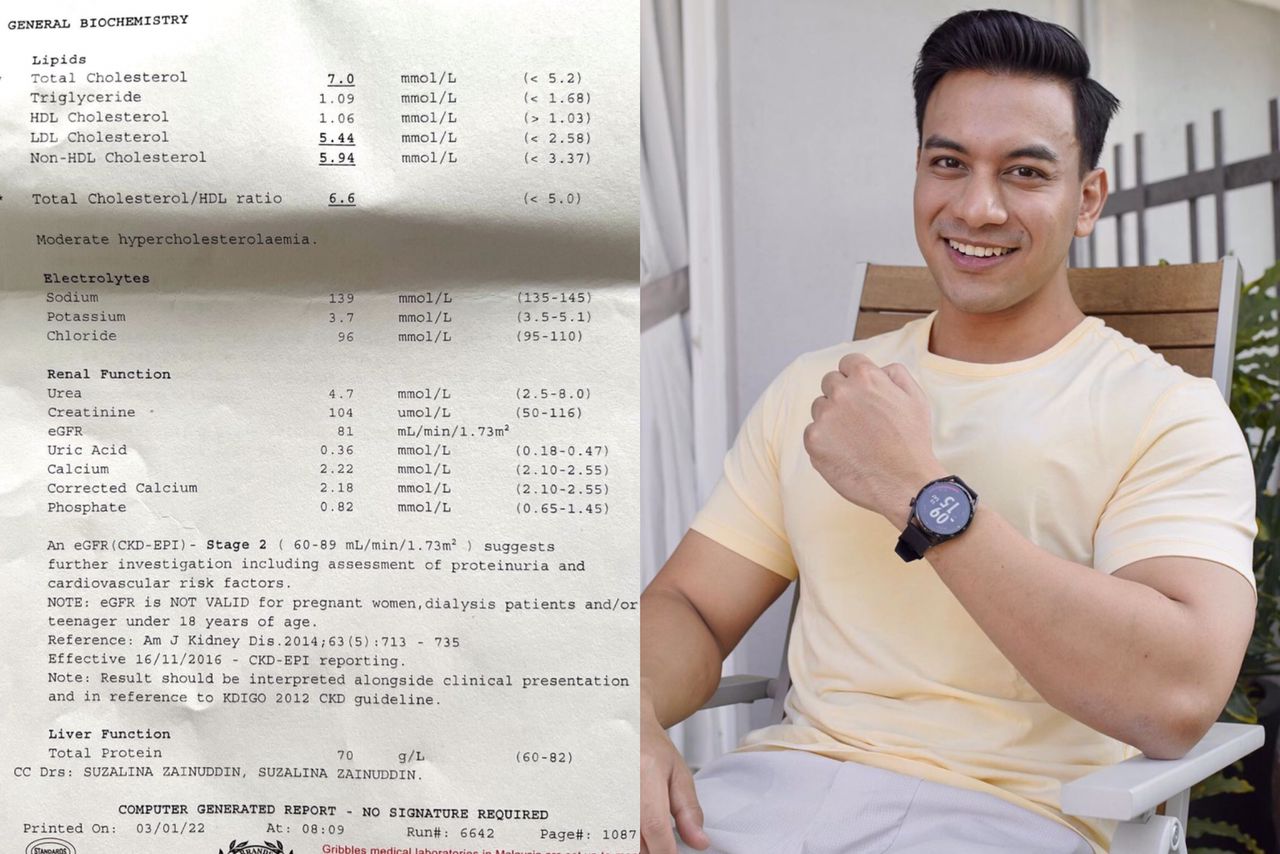 ١٩ ربيع الأول ١٤٣٧ هـ. Dr Say Shazril Risau Hadapi Kerosakan Buah Pinggang Tahap 2 Air Kencing Berdarah Xtra