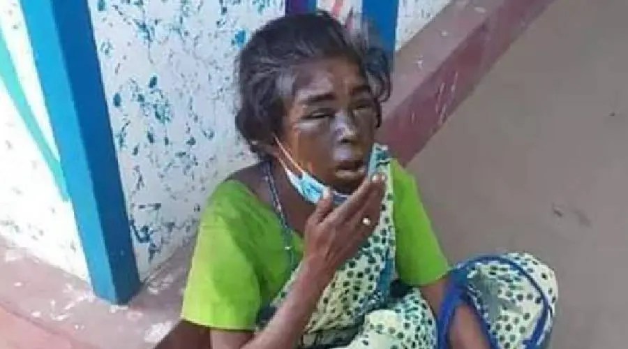 நீ பரதேசி பெண்… வயிற்று பசிக்காக வேலை கேட்டு வந்த இலங்கை பெண்ணின் முகத்தில் சுடுதண்ணி ஊற்றிய பாதகி! துடித் துடித்த அவலம்