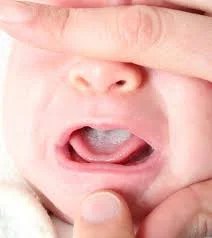 Totlapan: तालू का इलाज कराने आये बच्चे का कर दिया खतना, पिता बोले- बेटे को हिंदू से मुस्लिम बना दिया 1 images 7 3