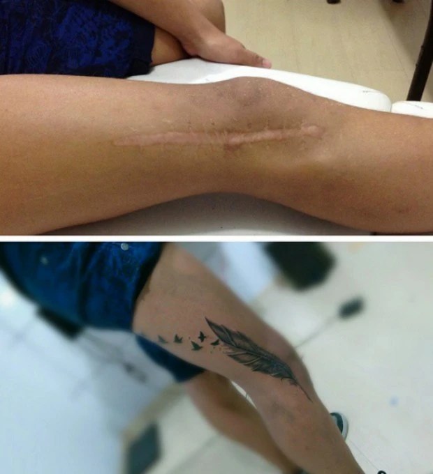 8 Gorgeous Tattoos For People With Scars | Yourtango 680_x_620_jpg