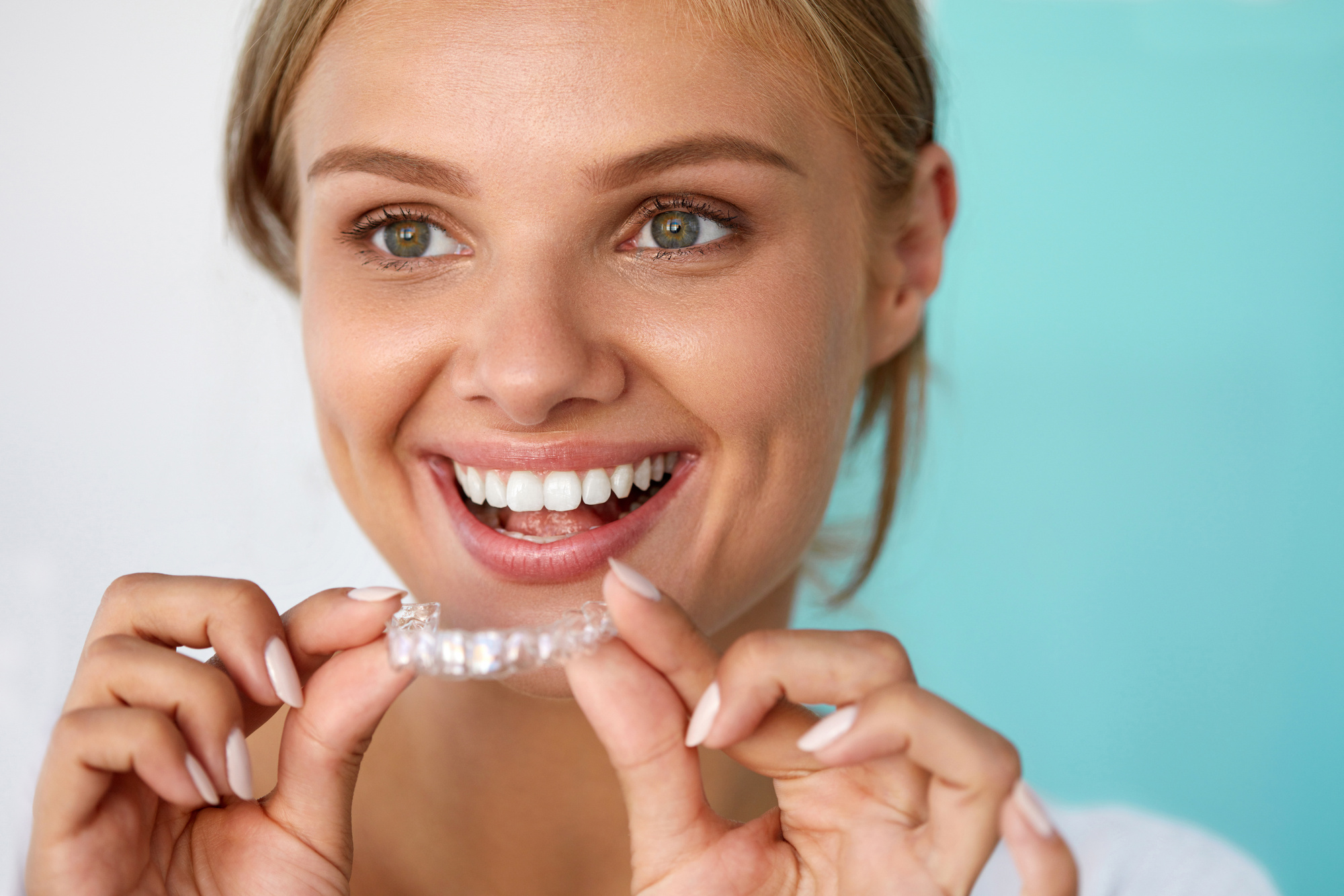 The step-by-step process of invisalign braces!