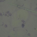 A Day in the Life of the PAZ Project: Laboratory diagnostic of diseases