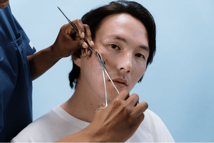 facial reconstruction