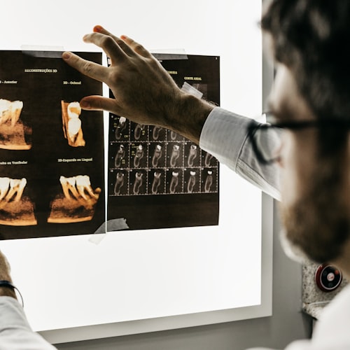 Customizable Lead Letters