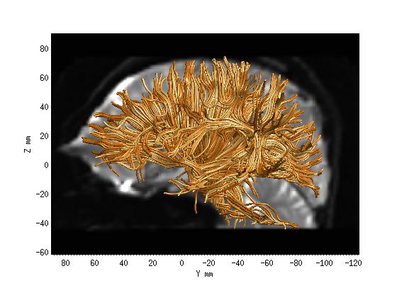 Afq Example - Premium Vintage Background Gallery - 8K