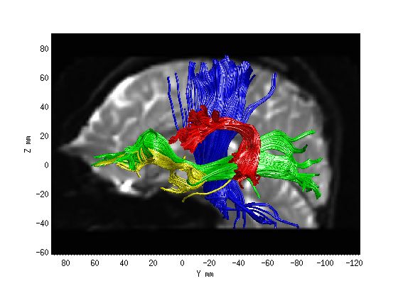 Afq Example - Creative Dark Art - Retina