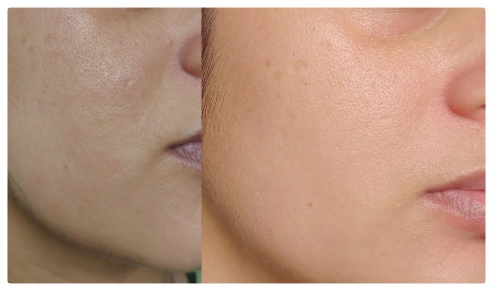 The Ordinary Niacinamide 10% Zinc 1% Serum Review
