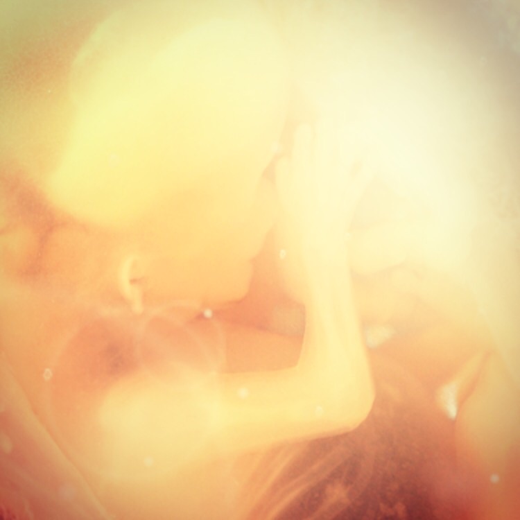 Week 10 of pregnancy – what to expect
