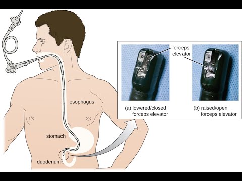 Removal Of Foreign Body By Egd Cpt Code Simplify Medical Coding