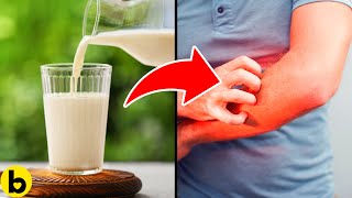 13 Common Foods That Can Make Your Skin Itch