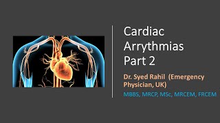Narrow Complex Tachycardia UNDER 10 MINUTES  - Learn the EASY WAY