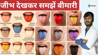 Tongue Color & Diseases Explained | What Does Your Tongue Color Say About Your Health?