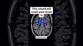Clear Head - Mind Boost