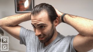 "I Look 10 YEARS Younger!" 🤯 Crop Haircut for RECEDING Hairline | Talking Hair Loss S2 EP9