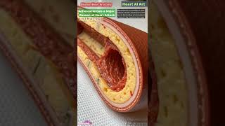 Atherosclerosis Animation | Heart AI Art | 07