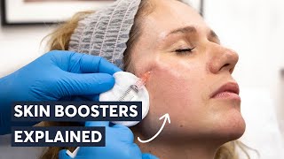 Exploring the Miracle of Skin Boosters: You Won't Believe What Happens Next!