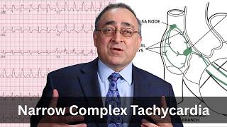 Narrow Complex Tachycardia | Case Review