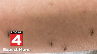 Consumer Reports: Putting insect repellents to the test