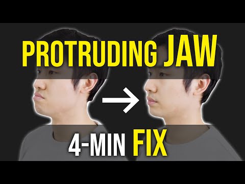 Protruding Jaw Underbite Fix Facial Asymmetry Correction Corrective Exercises