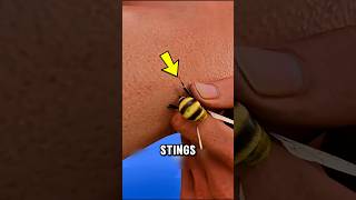 The Truth About Bee Stings: Do Bees Really Die After Stinging You? 🐝