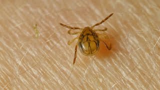 Lyme disease cases surge in Michigan as tick populations grow