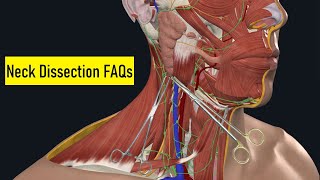 Stream Neck Dissection Surgical Anatomy: OR FAQs & Answers [201] Didactic Online