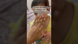 Mosquito bite remedy for babies #cute #baby #babygirl #cutebaby #viral #trendingshorts #smile