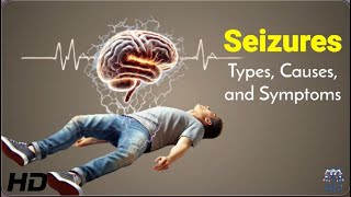Seizures Types, Causes, and Symptoms 1080p 240930