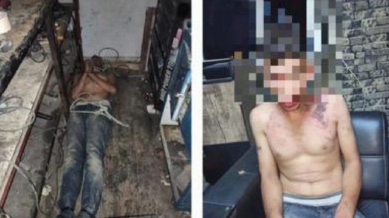 Suruç´lu Vedat Kurt yevmiyesini istediği için  işkence gördü: Dişleri söküldü