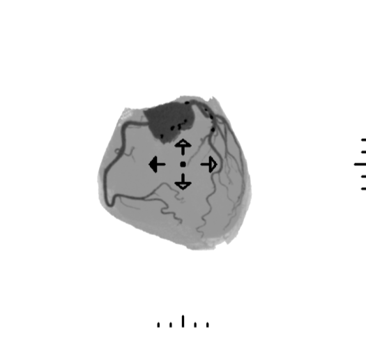 pien01