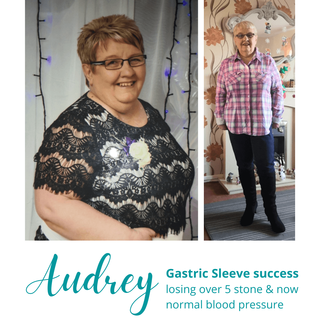 Audrey's Gastric Sleeve Success