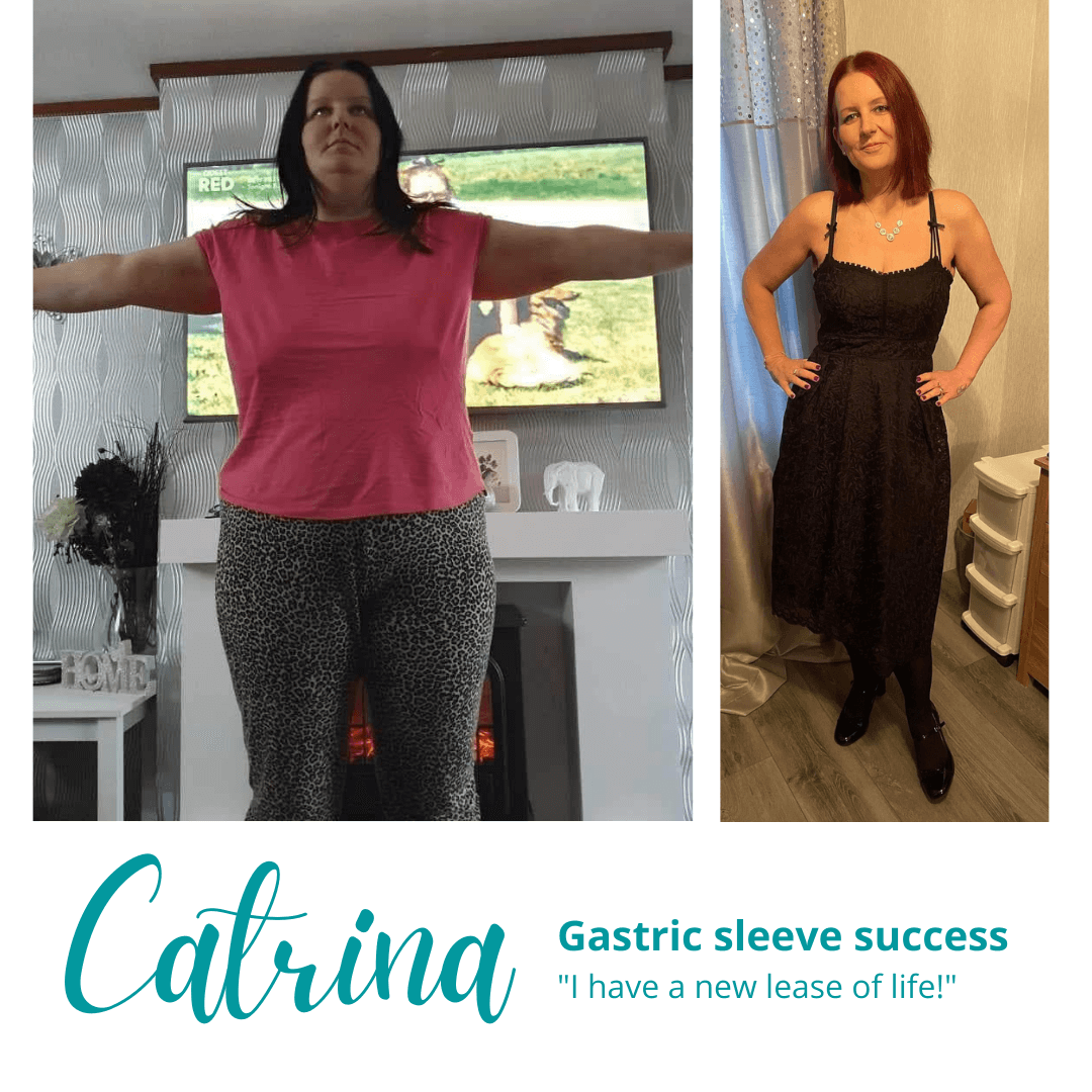 Gastric Sleeve