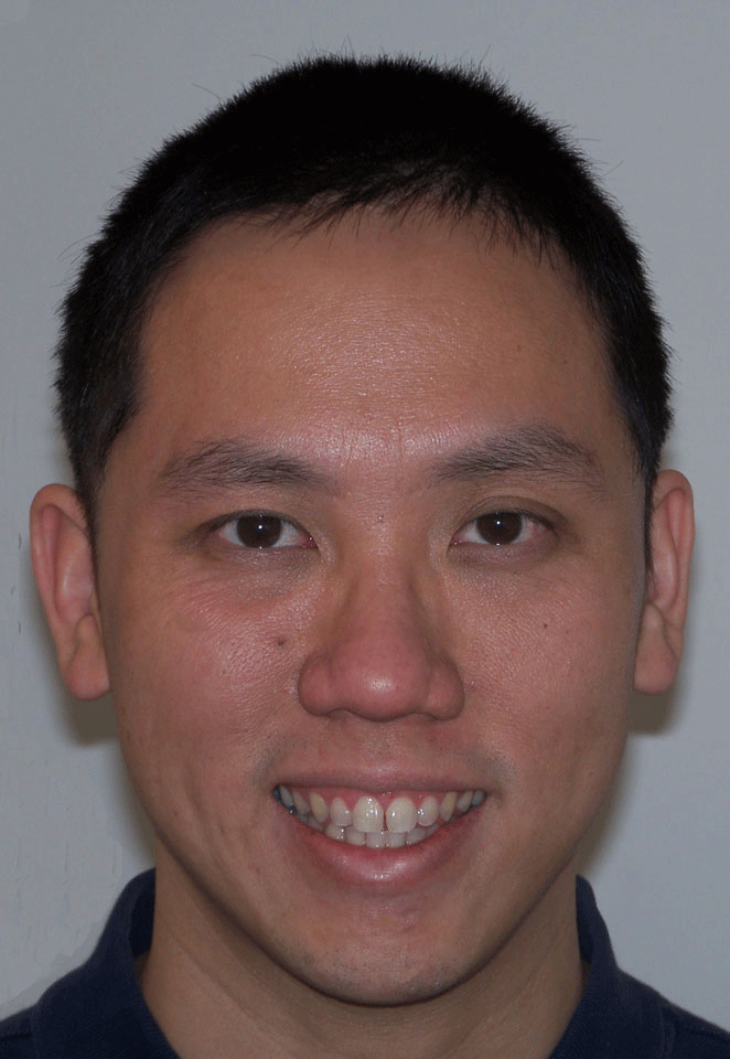 gnguyen