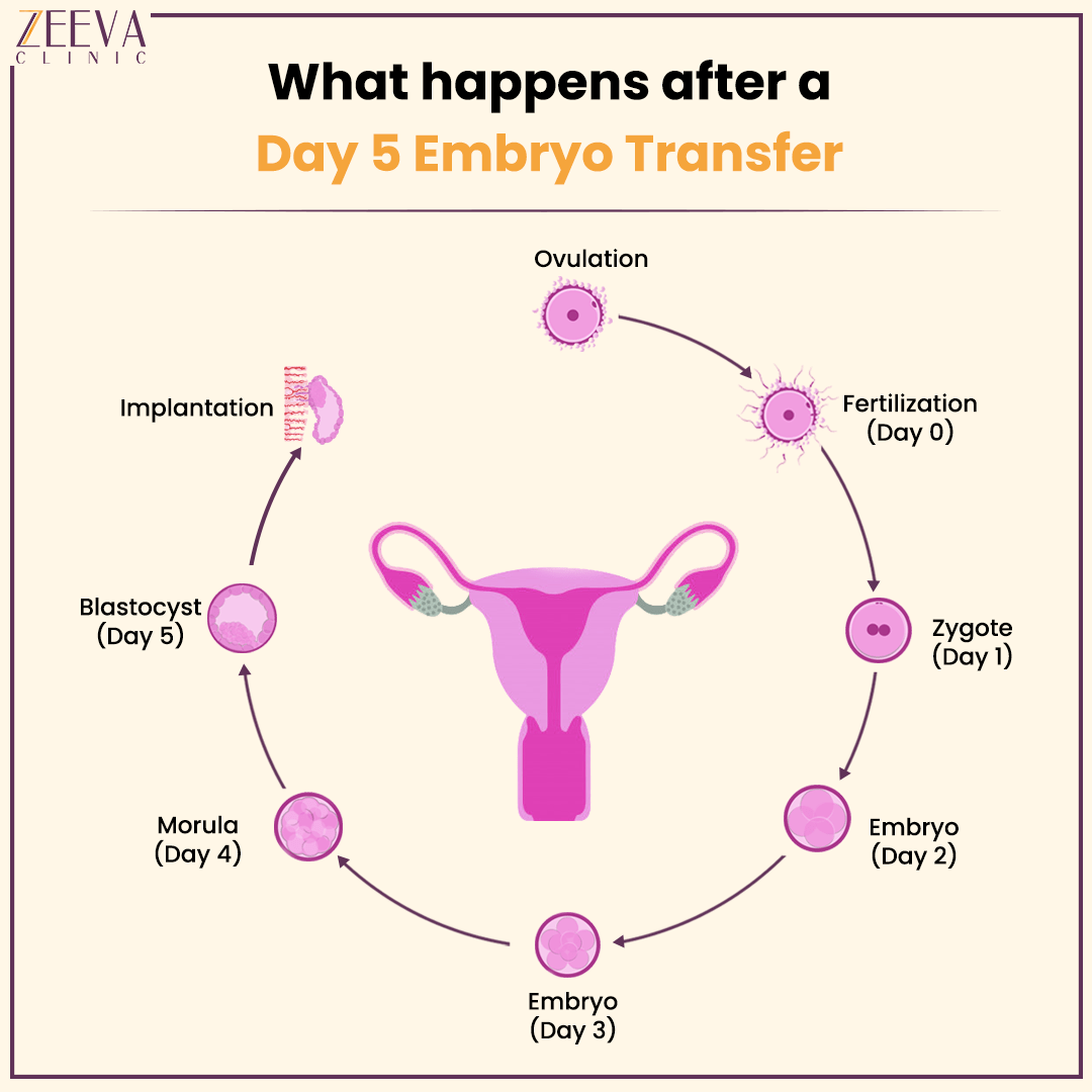 Embryo Transfer
